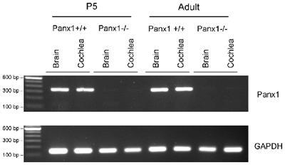 Mouse Panx1 Is Dispensable for Hearing Acquisition and Auditory Function